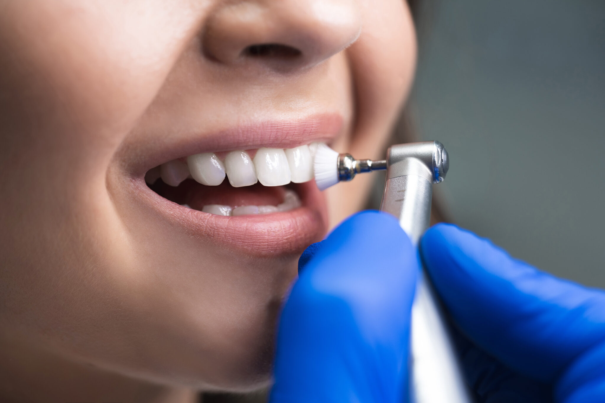 Periodontal Maintenance vs. Routine Cleaning Dentist in Colleyville, TX